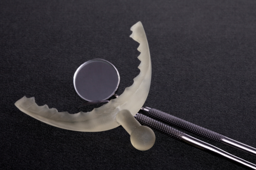 Non-Okklusales Attachment, patientenindividuell gedruckt